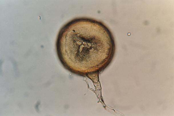 Glomusmossae73521483805216.png